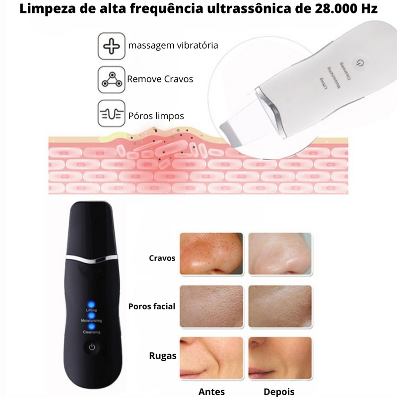 Espátula Peeling Ultrasónica - Para Puntos Negros